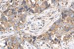 SPHK2 Antibody in Immunohistochemistry (Paraffin) (IHC (P))