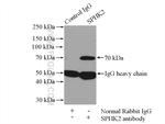 SPHK2 Antibody in Immunoprecipitation (IP)