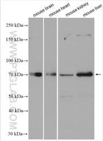 SPHK2 Antibody in Western Blot (WB)