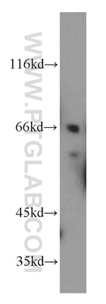 SPHK2 Antibody in Western Blot (WB)