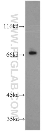 SPHK2 Antibody in Western Blot (WB)