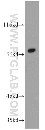 SPHK2 Antibody in Western Blot (WB)