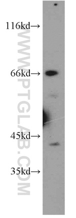 SPHK2 Antibody in Western Blot (WB)