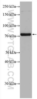 SPHK2 Antibody in Western Blot (WB)