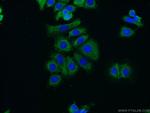 RUNDC3B Antibody in Immunocytochemistry (ICC/IF)
