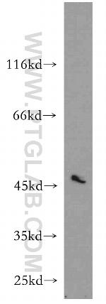 RUNDC3B Antibody in Western Blot (WB)