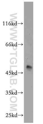 RUNDC3B Antibody in Western Blot (WB)