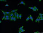 UPF3A Antibody in Immunocytochemistry (ICC/IF)