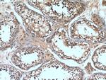 UPF3A Antibody in Immunohistochemistry (Paraffin) (IHC (P))