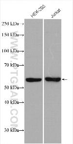 UPF3A Antibody in Western Blot (WB)