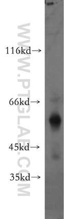 UPF3A Antibody in Western Blot (WB)