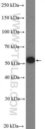 UPF3A Antibody in Western Blot (WB)