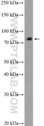 KLHL11 Antibody in Western Blot (WB)