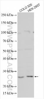PIGX Antibody in Western Blot (WB)