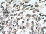 RASGEF1A Antibody in Immunohistochemistry (Paraffin) (IHC (P))