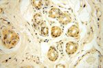 OXCT2 Antibody in Immunohistochemistry (Paraffin) (IHC (P))