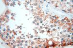 OXCT2 Antibody in Immunohistochemistry (Paraffin) (IHC (P))