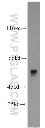 OXCT2 Antibody in Western Blot (WB)