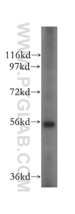 OXCT2 Antibody in Western Blot (WB)