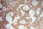 CSNK1A1L Antibody in Immunohistochemistry (Paraffin) (IHC (P))