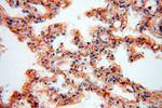 CSNK1A1L Antibody in Immunohistochemistry (Paraffin) (IHC (P))