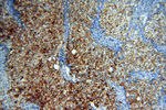 CSNK1A1L Antibody in Immunohistochemistry (Paraffin) (IHC (P))