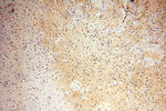 CSNK1A1L Antibody in Immunohistochemistry (Paraffin) (IHC (P))