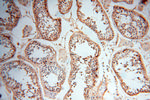 CSNK1A1L Antibody in Immunohistochemistry (Paraffin) (IHC (P))