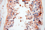 CSNK1A1L Antibody in Immunohistochemistry (Paraffin) (IHC (P))