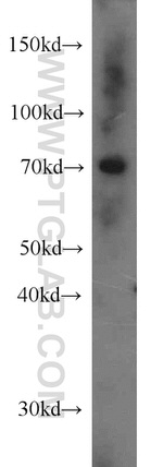 CSNK1A1L Antibody in Western Blot (WB)