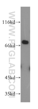 CSNK1A1L Antibody in Western Blot (WB)
