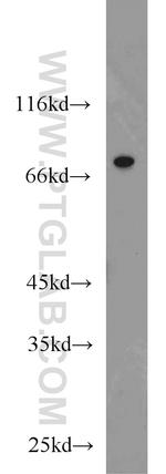 CSNK1A1L Antibody in Western Blot (WB)