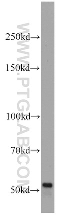 GALNTL5 Antibody in Western Blot (WB)