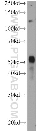 GALNTL5 Antibody in Western Blot (WB)