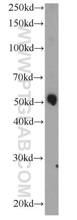 GALNTL5 Antibody in Western Blot (WB)