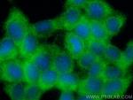 TKTL2 Antibody in Immunocytochemistry (ICC/IF)