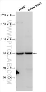 TKTL2 Antibody in Western Blot (WB)