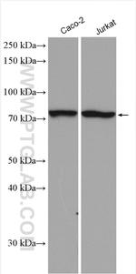 ACSS1 Antibody in Western Blot (WB)
