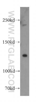 FBXL13 Antibody in Western Blot (WB)