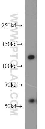 FBXL13 Antibody in Western Blot (WB)