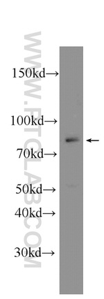 CKAP2L Antibody in Western Blot (WB)