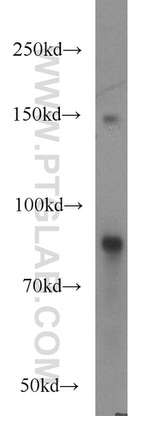 FAM160B2 Antibody in Western Blot (WB)