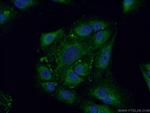 FAM160B2 Antibody in Immunocytochemistry (ICC/IF)