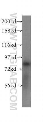 FAM160B2 Antibody in Western Blot (WB)