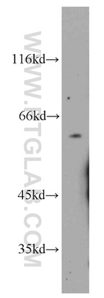 PGS1 Antibody in Western Blot (WB)