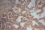 FCRLB Antibody in Immunohistochemistry (Paraffin) (IHC (P))