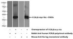 FCRLB Antibody in Western Blot (WB)