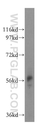FCRLB Antibody in Western Blot (WB)