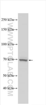 N4BP2L2 Antibody in Western Blot (WB)