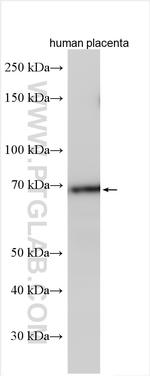 N4BP2L2 Antibody in Western Blot (WB)